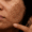 pigmentation