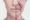 Anti-Aging Treatment