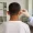 Prominent ear correction